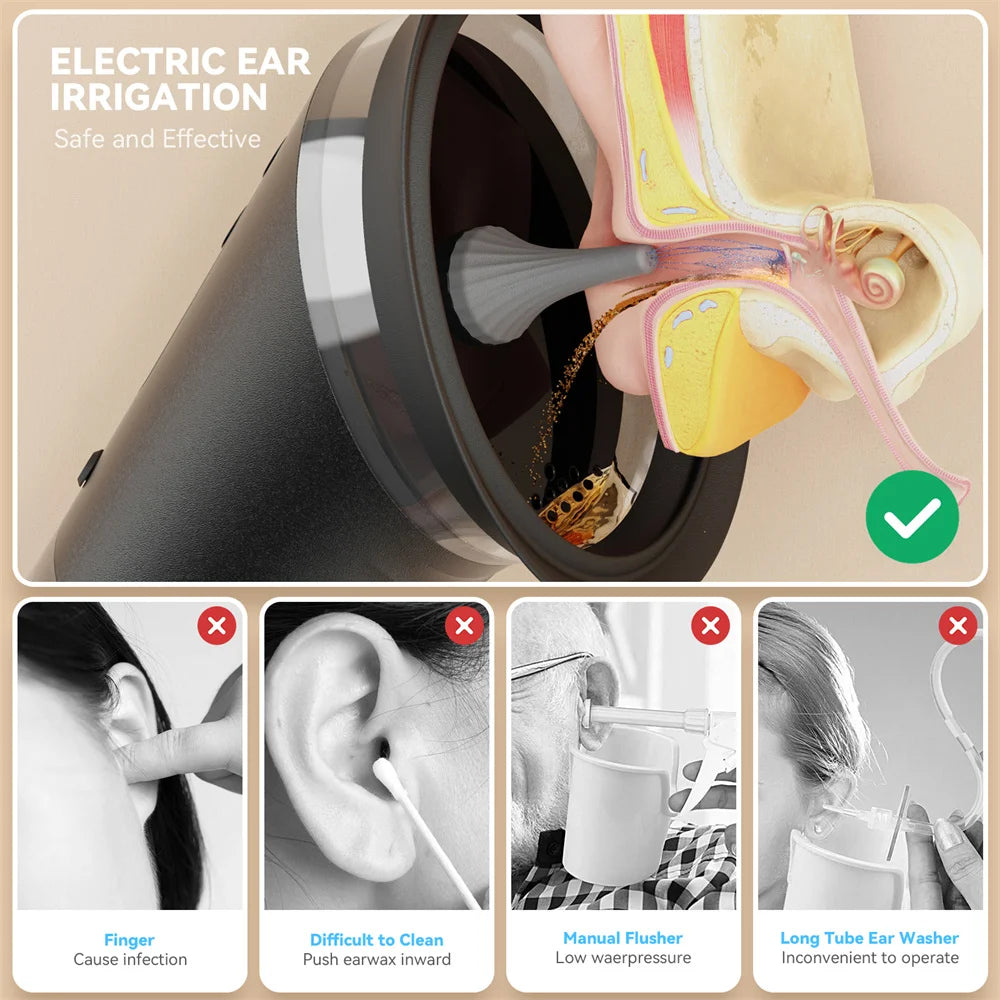 Système de Nettoyage d’Oreilles Hydro-Pulsé - Island Glow