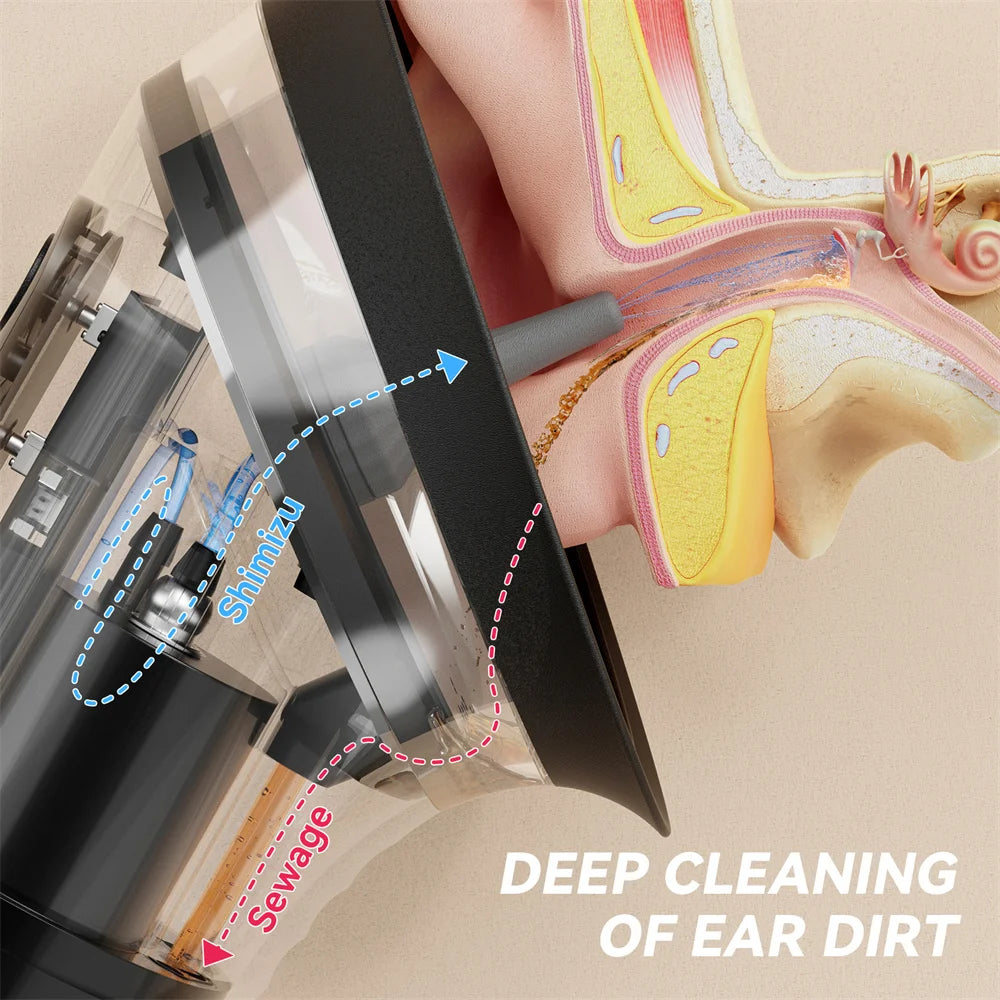 Système de Nettoyage d’Oreilles Hydro-Pulsé - Island Glow